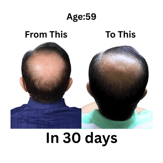 Alak: Rediscover Hair Health with Ayurveda, Not Chemicals - Alak Gentlemen