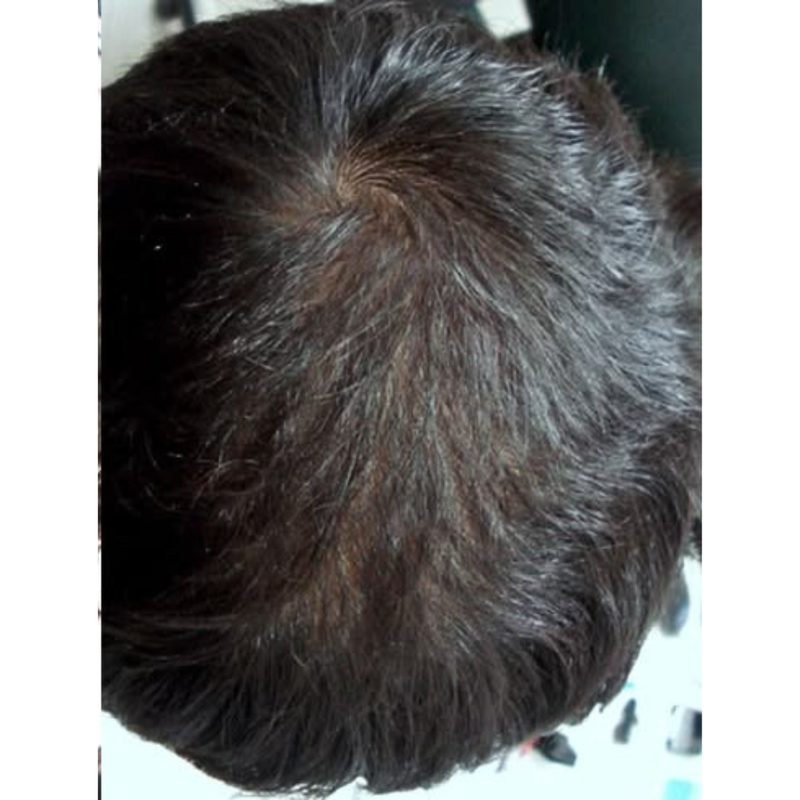 Before