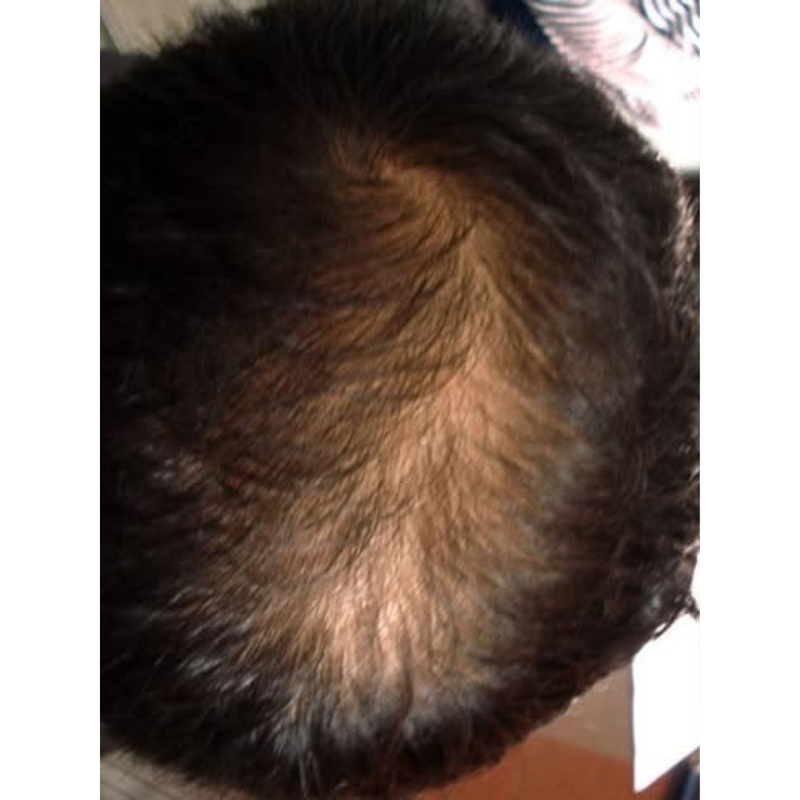 After