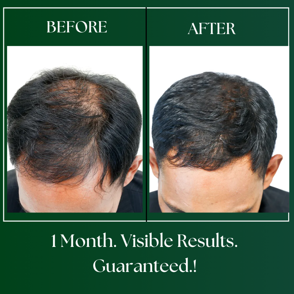 ayurvedic hair