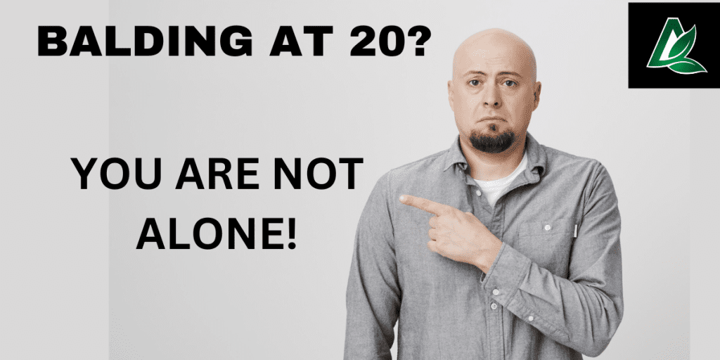 Balding at 20